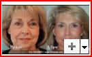Houston Texas Facelift Houston Texas Liposuction Facelift Breast Augmentation